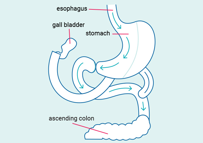 Biliopancreatic.jpg